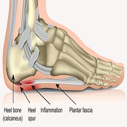 Foot Pain and Problems Foot Pain and Problems