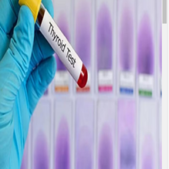 Lab test Image