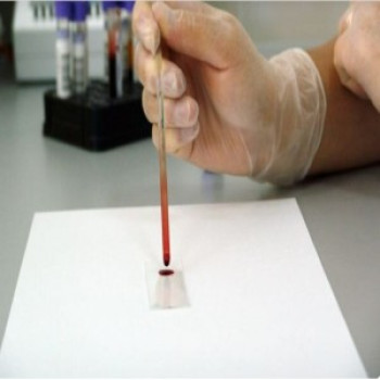 Lab test Image