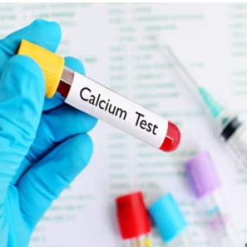 Lab test Image