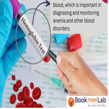 Lab test Image