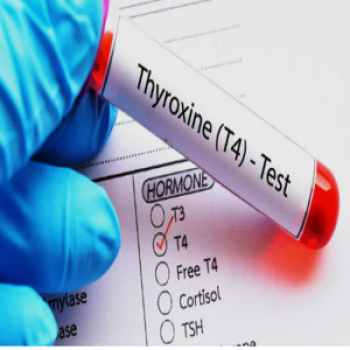 TOTAL THYROXINE (T4)-Redcliffe